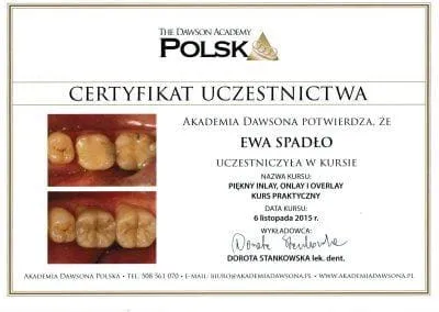 Dentysta Gliwice Leczenie Endodontyczne